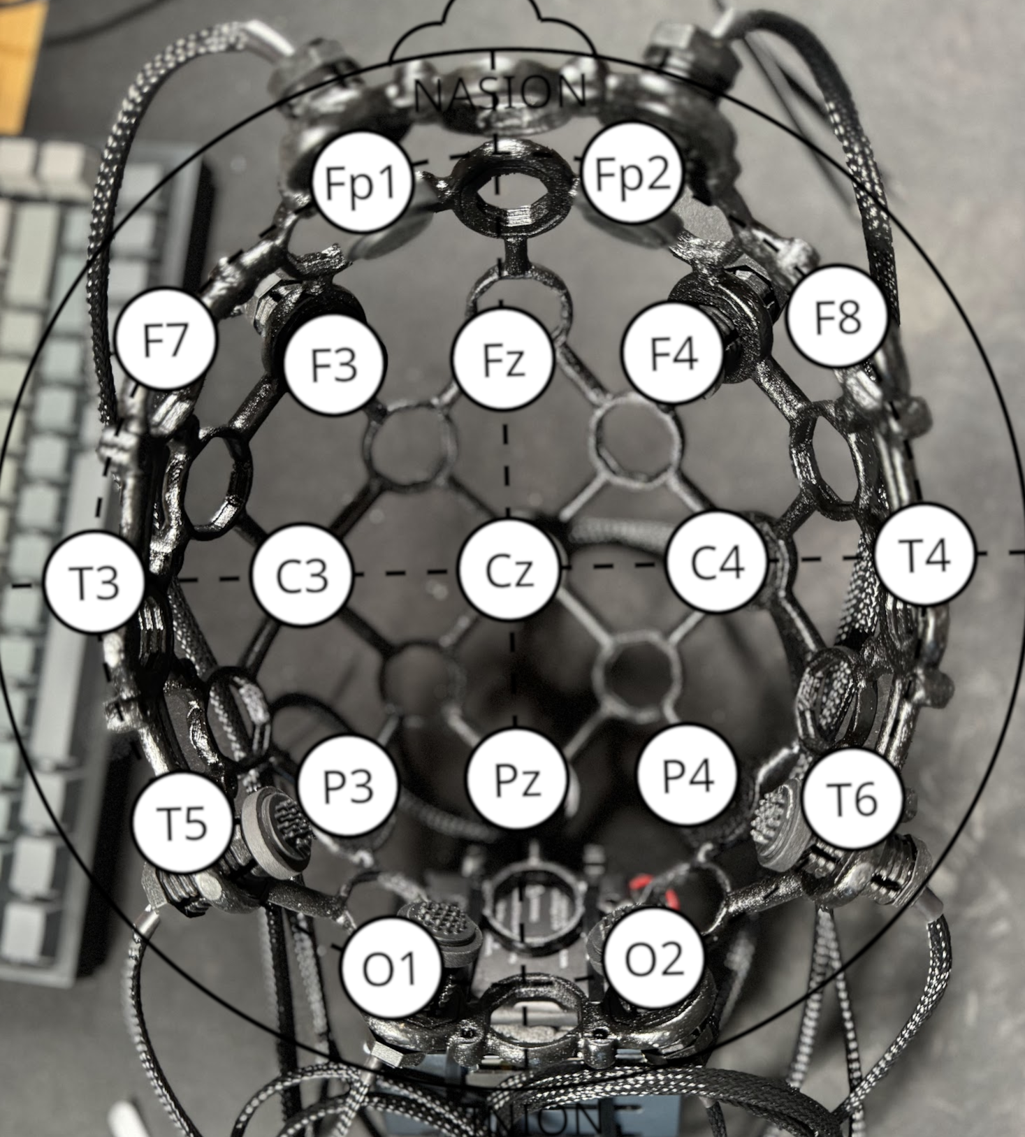 10-20 Electrode Placement