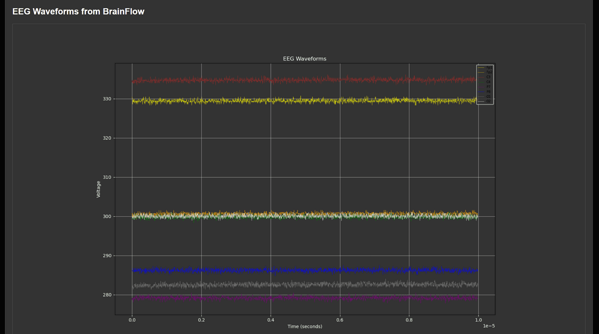 EEG Signal Plot